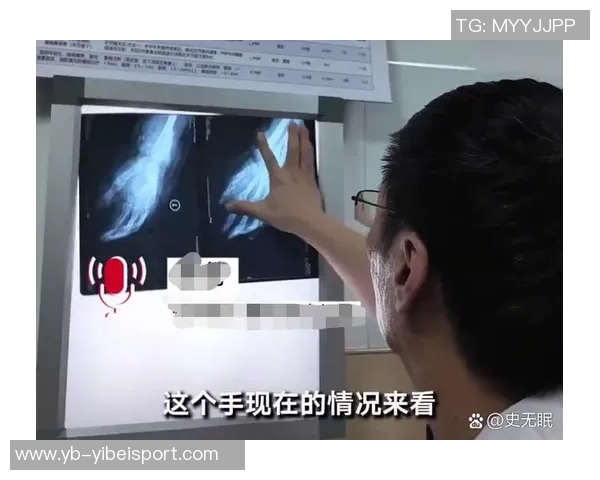 杜埃伤情乐观无需手术恢复时间预计为六到八周